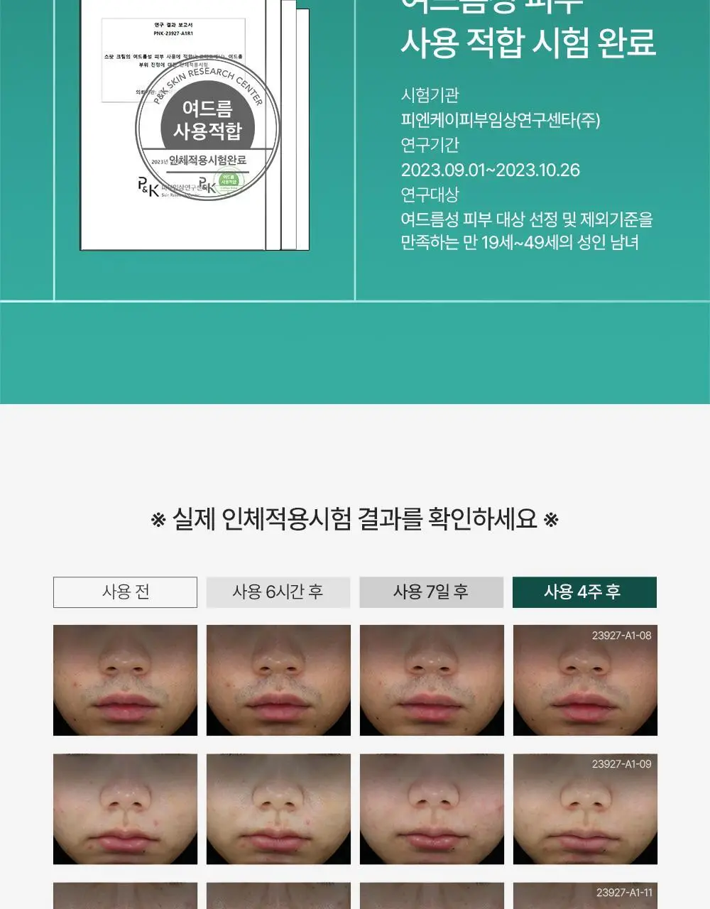 [트러블부위 진정케어] 피캄 센텔라 트러블 스팟 15ml 상세페이지 27